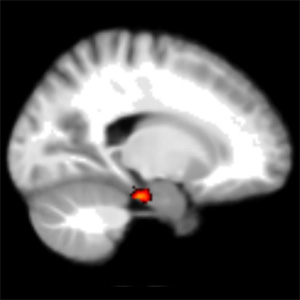 Homing signal in the brain