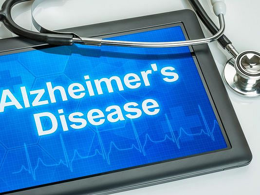 Preventing Alzheimer's Disease: What Do We Know?
